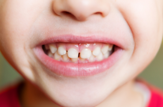 The Why of Oral Hygiene for Kids